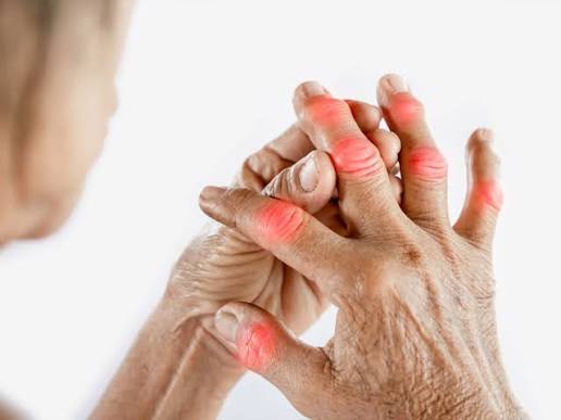 Arthritis Care